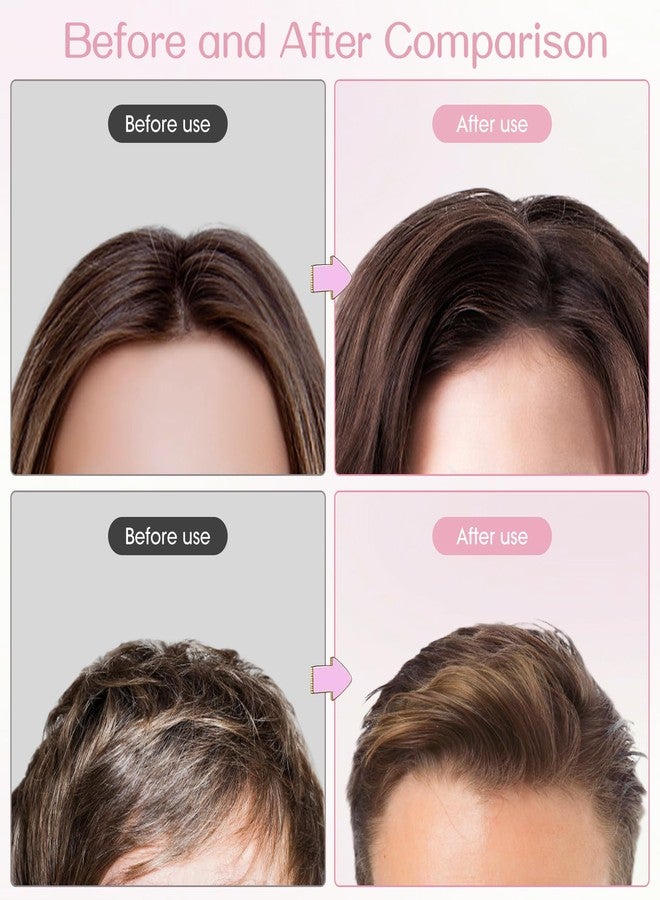 JANFUN Volumizing Hair Clips for Women 2PCS, Hair Volume Clip Styling Tools Volumizing Comb for Fluffy Bangs Clips for Root Lift, Root Booster Clips - Image 5